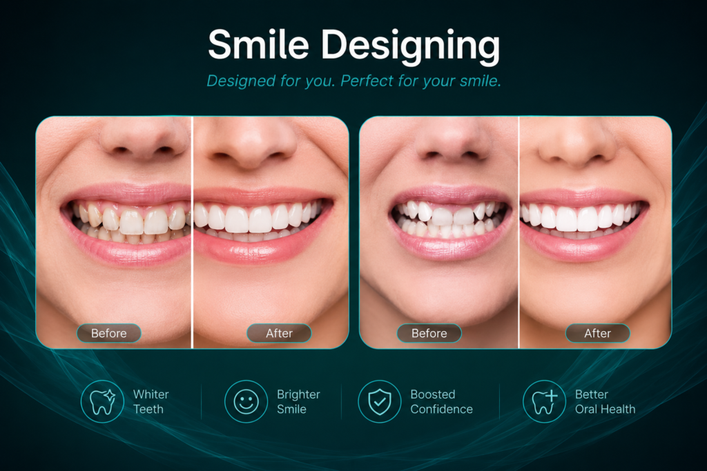 Smile Designing